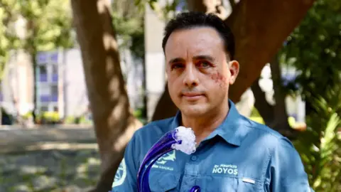 Galapagos Shark Attack: Biologist Shares Incredible Survival Story