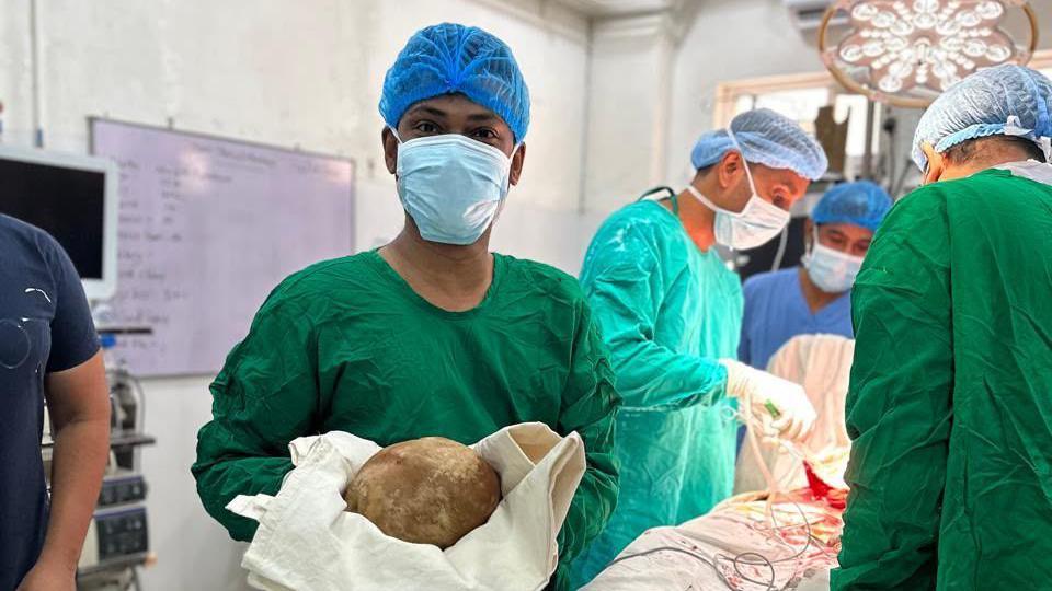Sri Lankan Surgeons Remove Record‑Breaking Bladder Stone, Opening New Frontiers in Urological Care