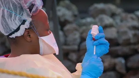 Ebola Outbreak Claims 80 Lives in Eastern DR Congo