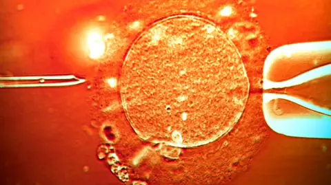Controversy Surrounds Genetic Risk After Sperm Donor Conceives Nearly 200 Children